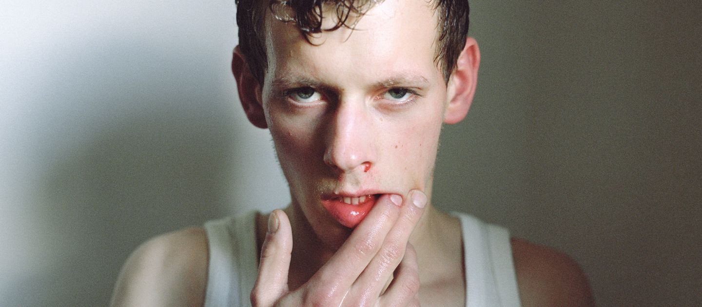 Das Foto zeigt einen jungen Mann, dem Blut aus der Nase läuft.