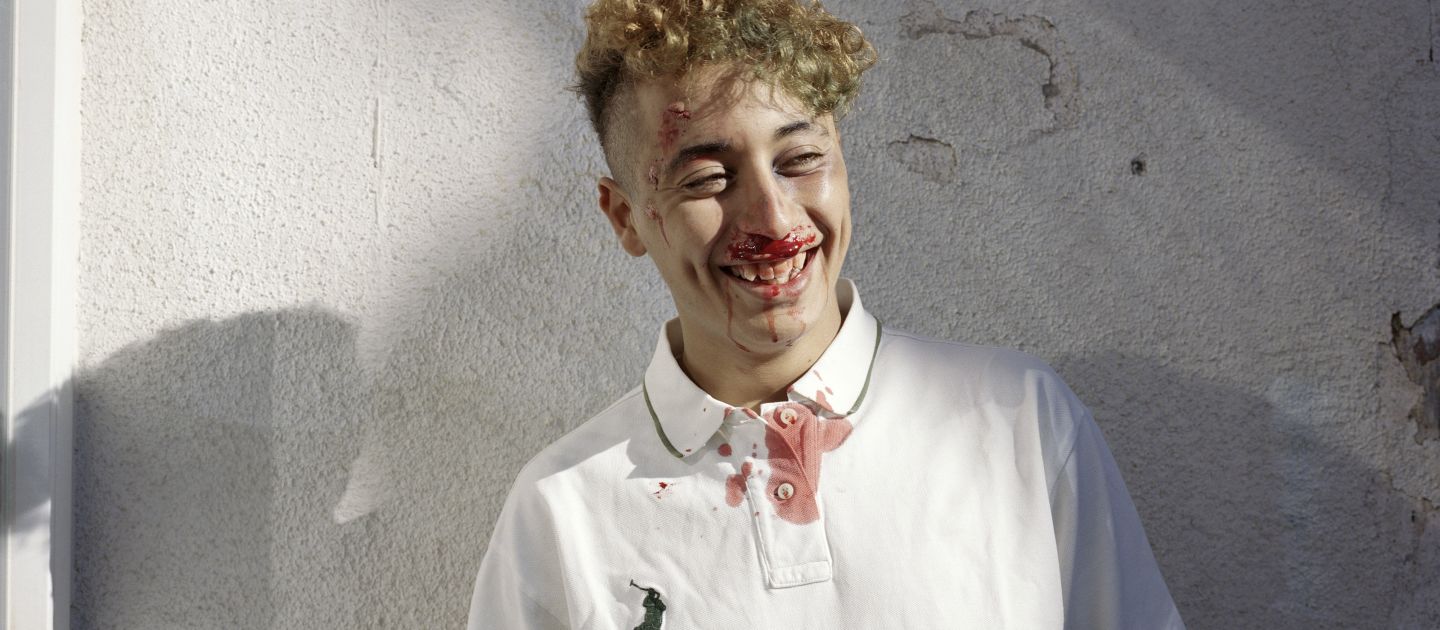 Das Foto zeigt einen Teenager, der aus Mund und Nase blutet. Er lacht.