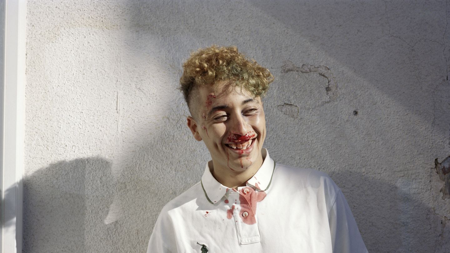 Das Foto zeigt einen lachenden Jungen mit blutendem Mund